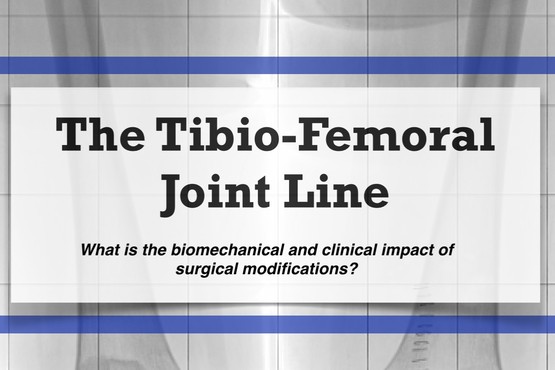Thesisverdediging Dr. Thomas Luyckx - The Tibio-Femoral Joint Line